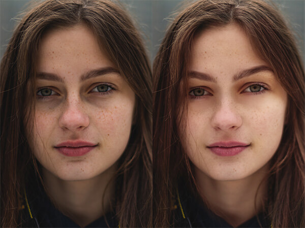 Montagem com 2 fotos de uma mulher com sardas mostrando o antes e depois.