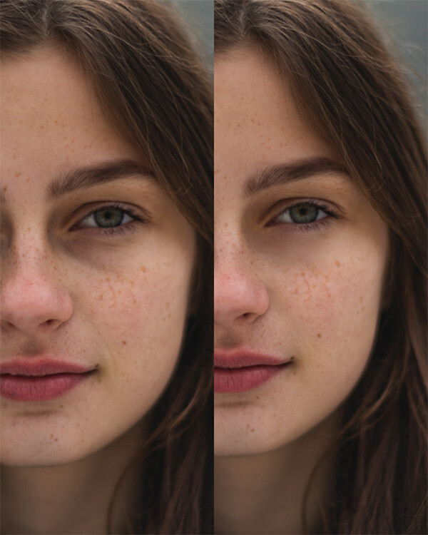 Montagem com 2 fotos de uma mulher com sardas mostrando o antes e depois. 